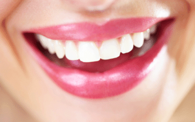 Dents blanches : 4 astuces naturelles pour un sourire éclatant