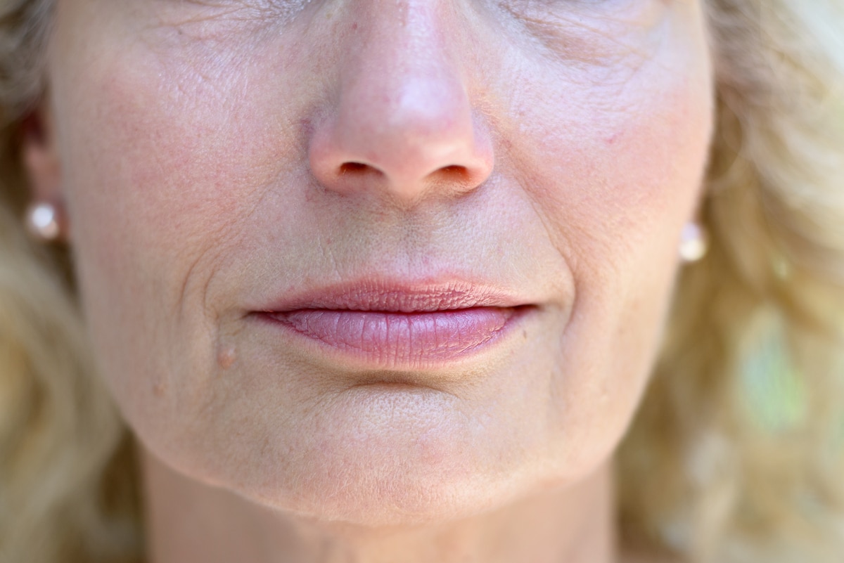 Rides du sourire : voici l'astuce d'une dermatologue pour les atténuer